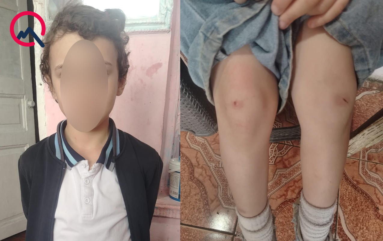 “4-cü sinif şagirdi nəvəmi məktəbin ayaqyolunda döyüb” - Foto