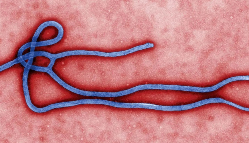 Beynəlxalq xəbərdarlıq: Ebola təhlükəsi böyüyür