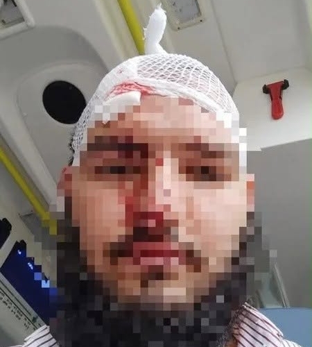 Varşavada azərbaycanlı sürücüyə hücum edildi - FOTOLAR
