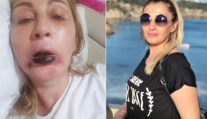 Gözəlləşmək istəyən qadını bu hala saldılar - FOTOLAR