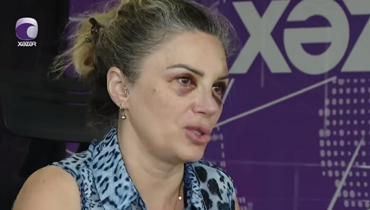 Bakıda mağazada döyülən qadın danışdı - VİDEO