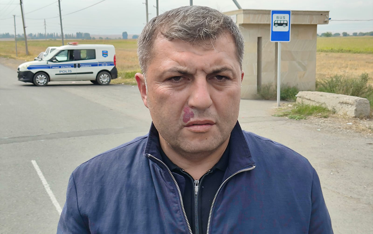 “Əhali hazırda təhlükəsiz şəraitdədir” - Video